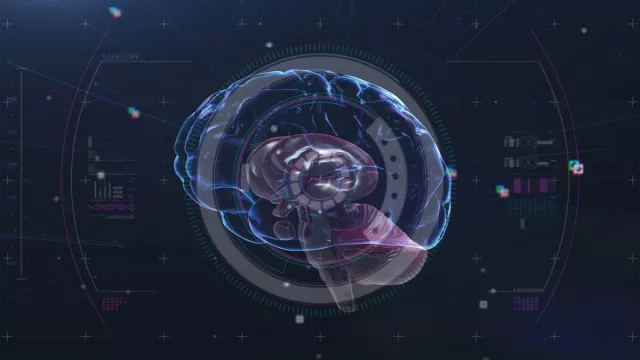 La Cina ha sviluppato il suo Neuralink - l'interfaccia cerebrale Neucyber proviene da una società di neurotecnologia