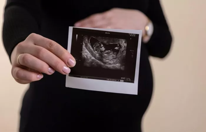 DopFone trasforma lo smartphone in un monitor fetale